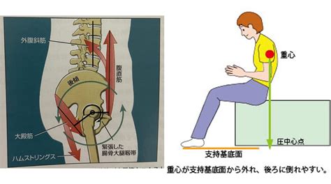 後面座位|「骨盤の前傾・後傾をつくる要因と、それにより起こ。